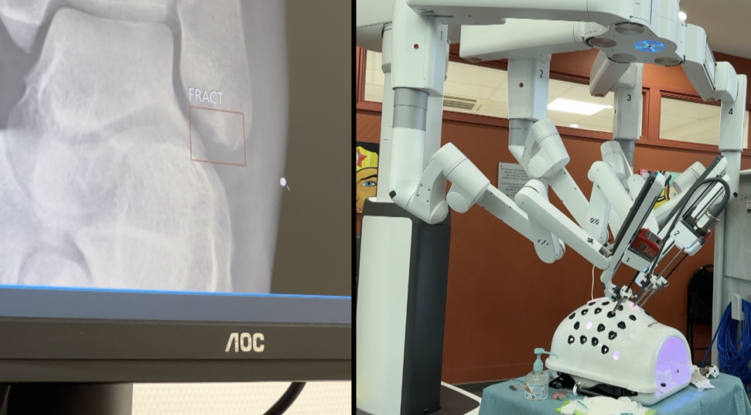 Mini-série : Quand les robots et l'IA s’invitent dans les hôpitaux