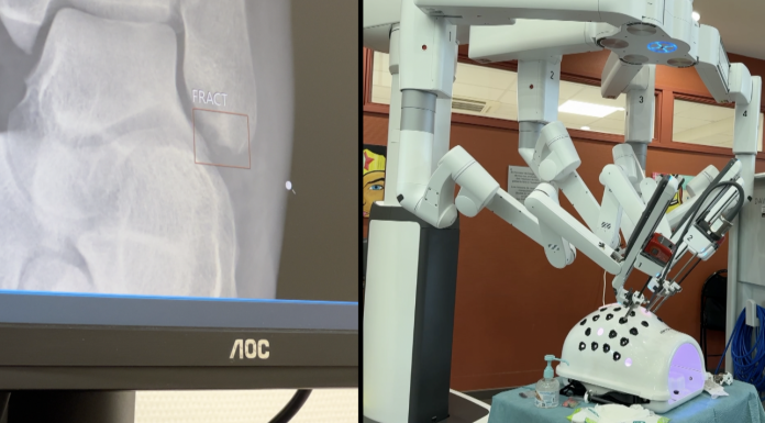 Mini-série : Quand les robots et l'IA s’invitent dans les hôpitaux