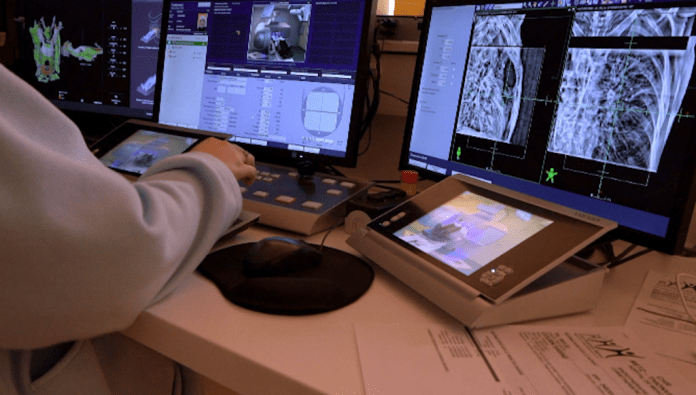 Des technologies de pointe pour traiter le cancer du poumon